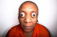 Click image for larger version.&nbsp;

Name:	102311_weird_eyeball.jpg&nbsp;
Views:	117&nbsp;
Size:	23.8 KB&nbsp;
ID:	36317
